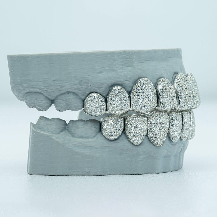 S925 Moissanite Custom Full Bust Down Grillz