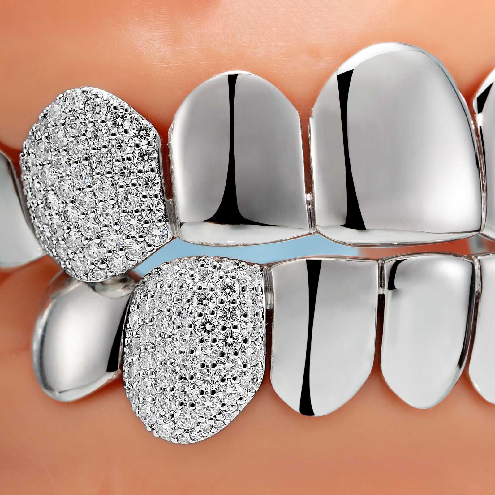 S925 Custom Polished Gold & Moissanite Diamond Grillz